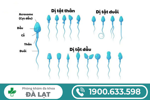 Hình ảnh minh họa